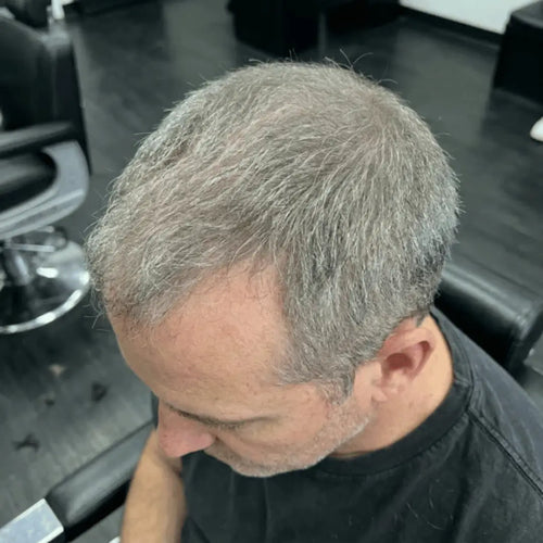 After