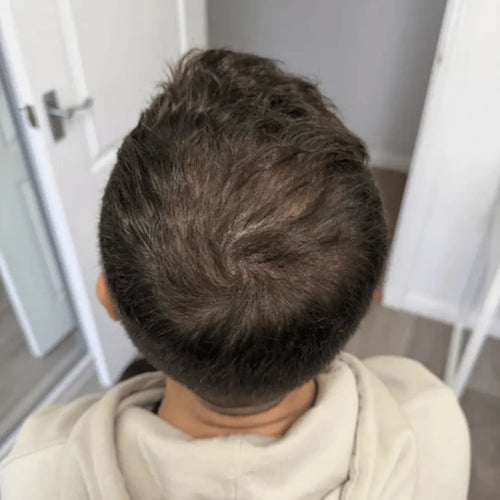 After